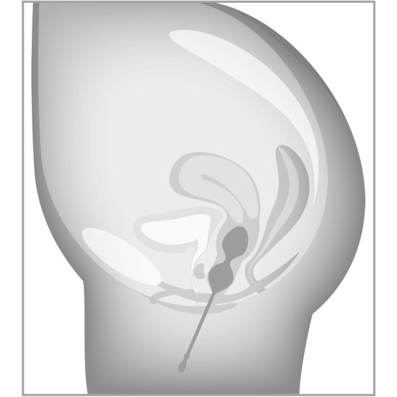 SET DI 3 PALLINE VAGINALI CON PESI E MISURE DIFFERENTI PER ALLENAMENTO DEL PAVIMENTO PELVICO ELORIN