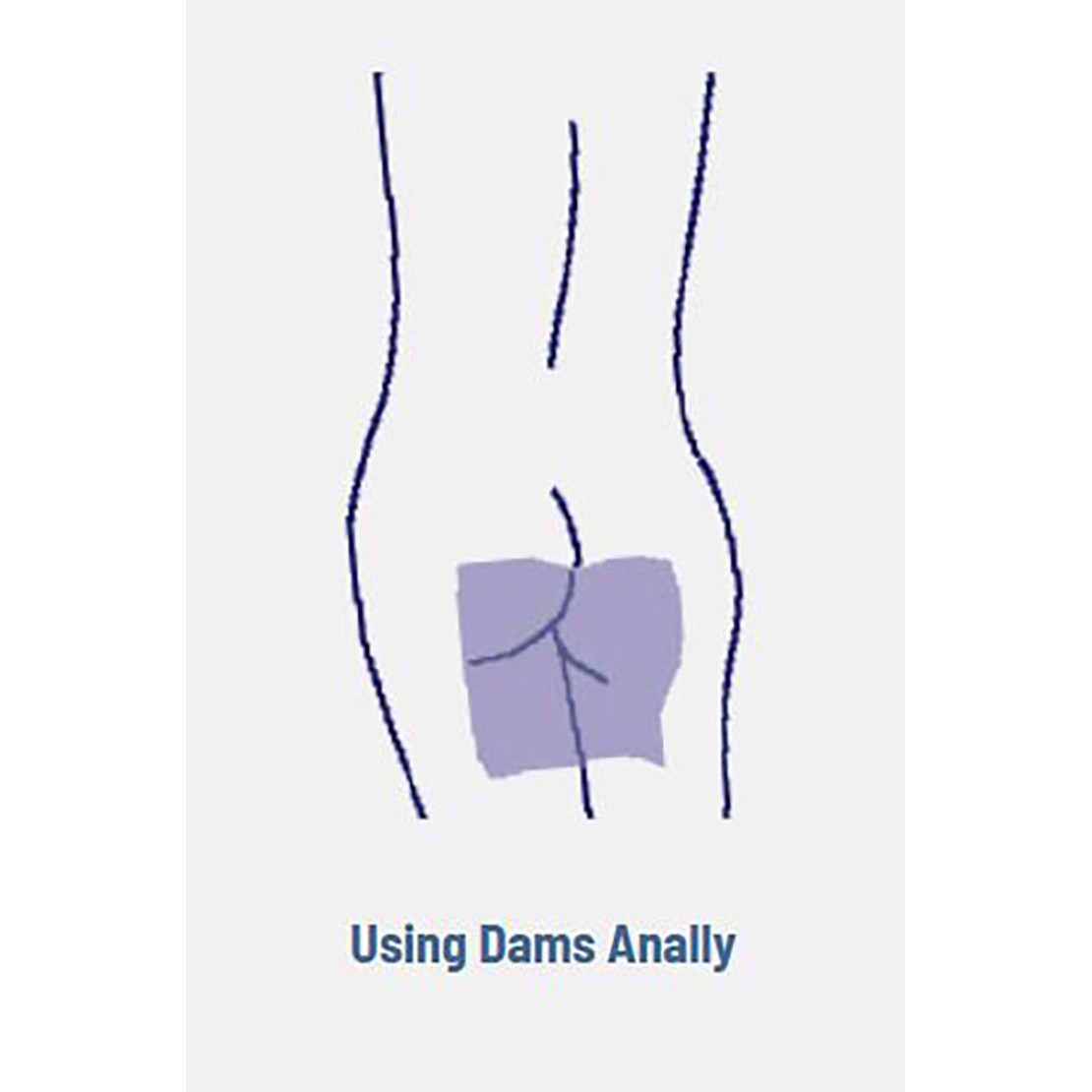 DAM PROFILATTICO