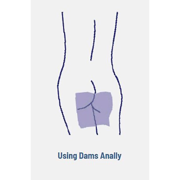 DAM PROFILATTICO